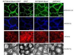 protection-of-enfothelial-cells-by-Hsp90抑制剂